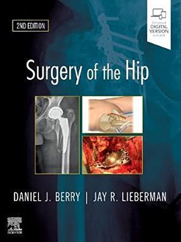 Beispielbild fr Surgery of the Hip zum Verkauf von Books Puddle