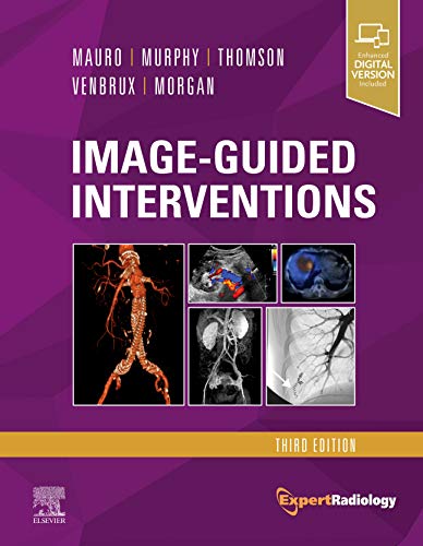 9780323612043: Image-Guided Interventions: Expert Radiology Series, 3e