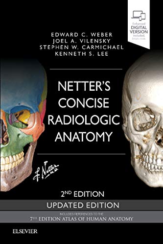9780323625326: Netter's Concise Radiologic Anatomy Updated Edition, 2ed