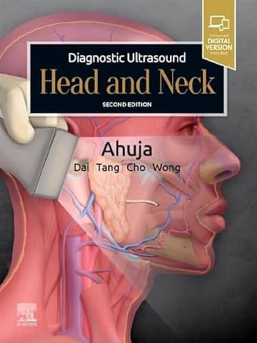 Beispielbild fr Diagnostic Ultrasound: Head and Neck zum Verkauf von Romtrade Corp.