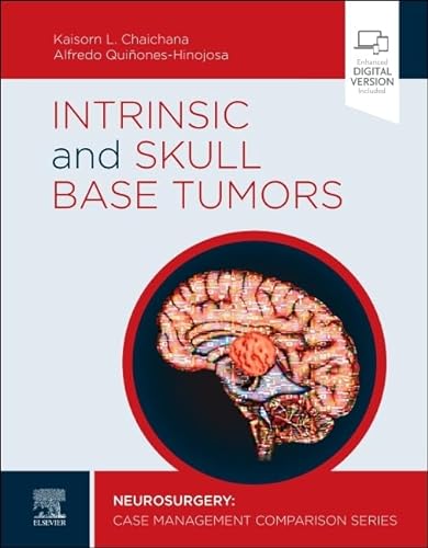 9780323696425: Intrinsic and Skull Base Tumors: Neurosurgery: Case Management Comparison Series
