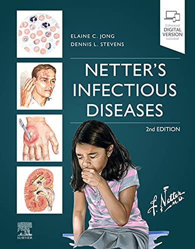 Imagen de archivo de Netters Infectious Diseases a la venta por Goodwill Industries of VSB