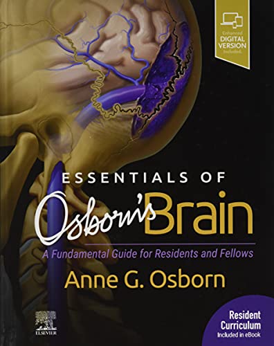 Beispielbild fr Essentials of Osborn's Brain: A Fundamental Guide for Residents and Fellows zum Verkauf von BooksRun