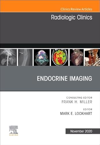 9780323720724: Endocrine Imaging , An Issue of Radiologic Clinics of North America (Volume 58-6) (The Clinics: Radiology, Volume 58-6)