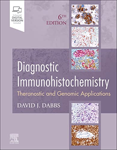 Stock image for Diagnostic Immunohistochemistry: Theranostic and Genomic Applications for sale by Textbooks_Source