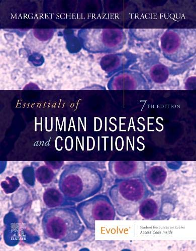 Imagen de archivo de ESSENTIALS OF HUMAN DISEASES AND CONDITIONS 7ED (PB 2021) a la venta por Basi6 International