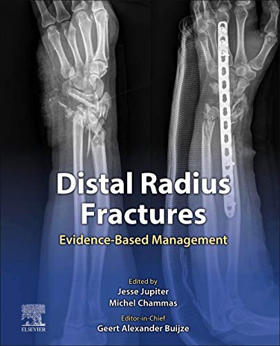 Stock image for Distal Radius Fractures: Evidence-Based Management for sale by Chiron Media