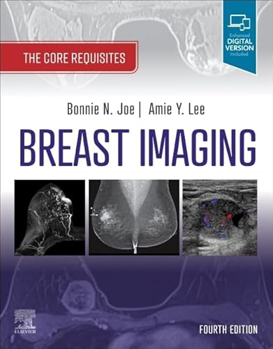9780323758499: Breast Imaging: The Core Requisites