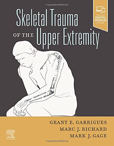 Stock image for Skeletal Trauma of the Upper Extremity for sale by SecondSale