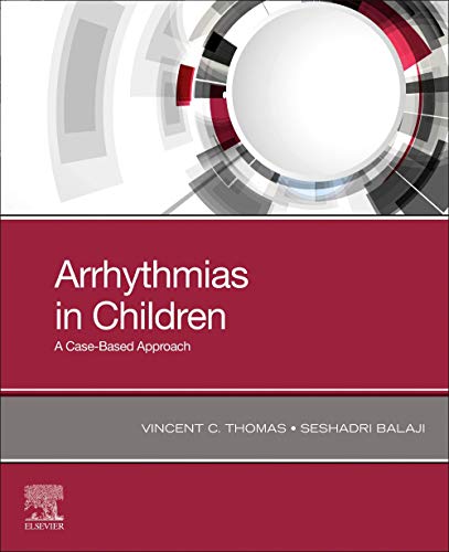 Beispielbild fr Arrhythmias in Children: A Case-Based Approach zum Verkauf von Monster Bookshop