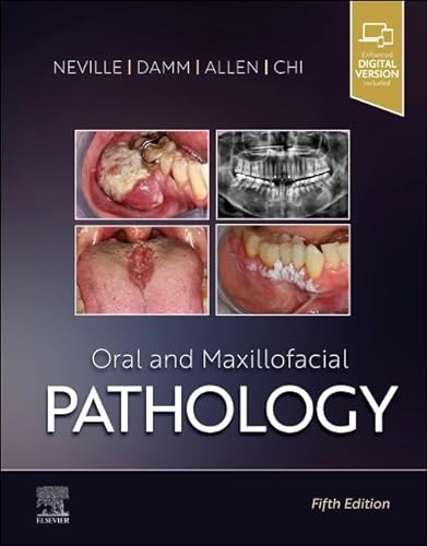 Imagen de archivo de Oral and Maxillofacial Pathology a la venta por BooksRun