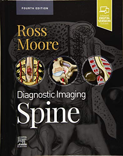 Beispielbild fr Diagnostic Imaging: Spine-4E zum Verkauf von Romtrade Corp.
