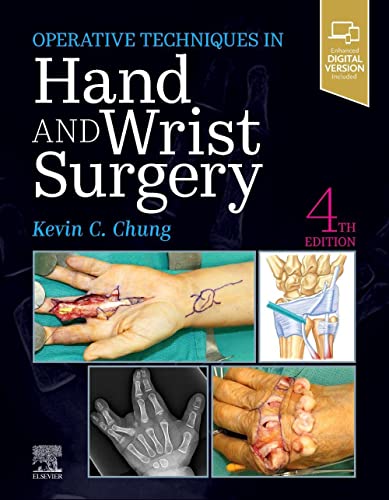 Stock image for OPERATIVE TECHNIQUES: HAND AND WRIST SURGERY: 4TH EDITION for sale by Basi6 International