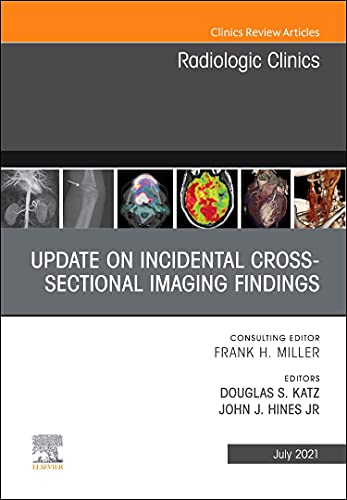 Stock image for Update on Incidental Cross-Sectional Imaging Findings, an Issue of Radiologic Clinics of North America for sale by Better World Books: West