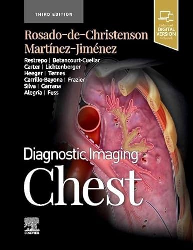 9780323796637: Diagnostic Imaging: Chest