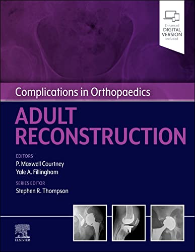 Imagen de archivo de Complications in Orthopaedics: Adult Reconstruction a la venta por BooksRun