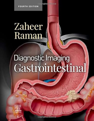 9780323824989: Diagnostic Imaging: Gastrointestinal