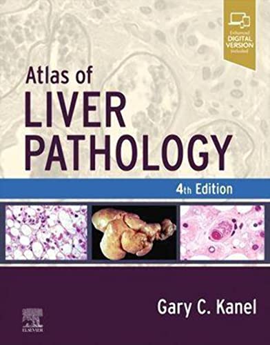 Stock image for Atlas of Liver Pathology (Atlas of Surgical Pathology) for sale by Book Deals