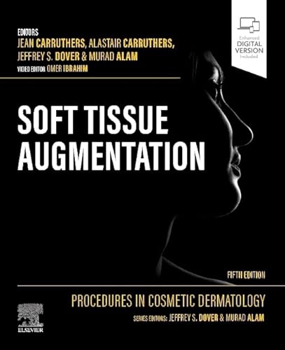 Beispielbild fr Soft Tissue Augmentation - zum Verkauf von Blackwell's