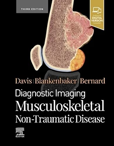 9780323834735: Diagnostic Imaging: Musculoskeletal Non-Traumatic Disease