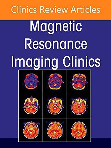Beispielbild fr MR Imaging of Head and Neck Cancer, an Issue of Magnetic Resonance Imaging Clinics of North America: Volume 30-1 zum Verkauf von ThriftBooks-Dallas