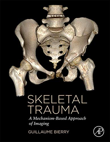 9780323854757: Skeletal Trauma: A Mechanism-based Approach of Imaging