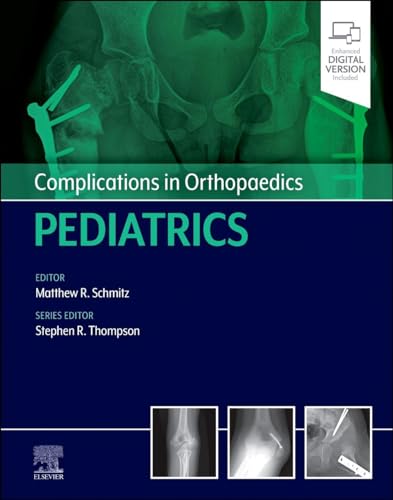 Beispielbild fr Schmitz - Complications in Orthopaedics: Pediatrics-1E zum Verkauf von Basi6 International