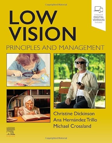 Beispielbild fr Low Vision: Principles and Management zum Verkauf von BooksRun