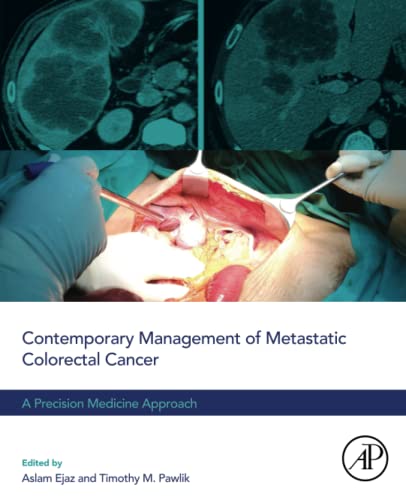 Beispielbild fr Contemporary Management of Metastatic Colorectal Cancer: A Precision Medicine Approach zum Verkauf von Brook Bookstore On Demand