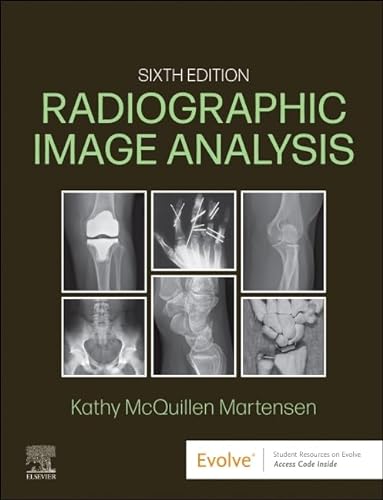 9780323930697: Radiographic Image Analysis