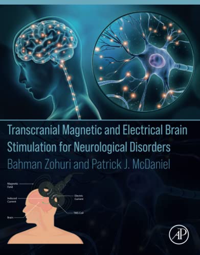 Stock image for Transcranial Magnetic and Electrical Brain Stimulation for Neurological Disorders for sale by Wonder Book