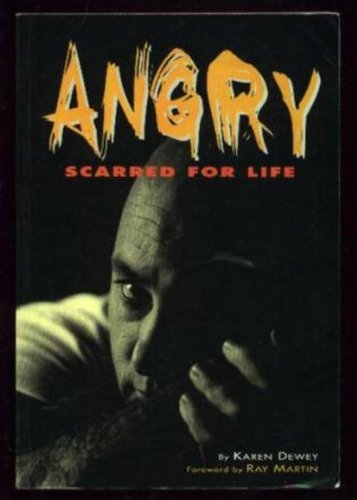 Angry: Scarred for Life