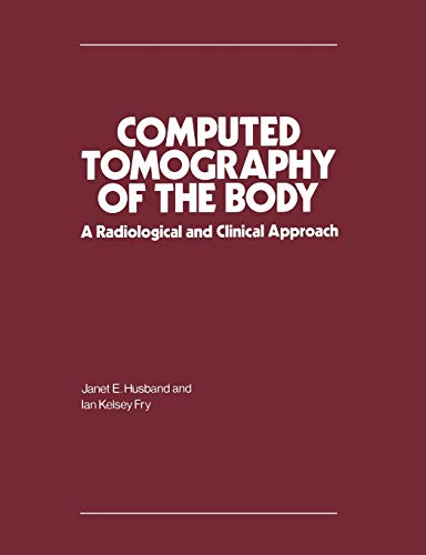 Imagen de archivo de Computed Tomography of the Body: A Radiological and Clinical Approach a la venta por Anybook.com