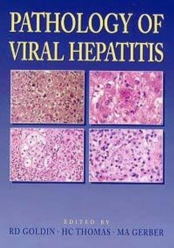 Beispielbild fr Pathology of Viral Hepatitis zum Verkauf von Chapter 1