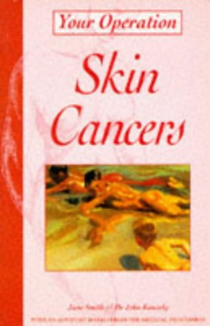 Imagen de archivo de Your Operation: Skin Cancers a la venta por AwesomeBooks