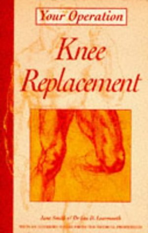 Stock image for Your Operation : Knee Replacement for sale by B-Line Books