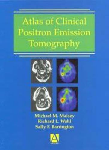 Imagen de archivo de Atlas of Clinical Positron Emission Tomography, a la venta por CSG Onlinebuch GMBH