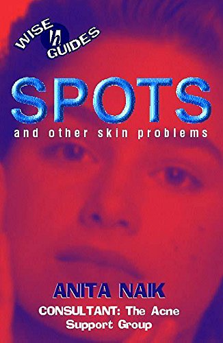 Imagen de archivo de Spots and Other Skin Problems (Wise Guides) a la venta por WorldofBooks