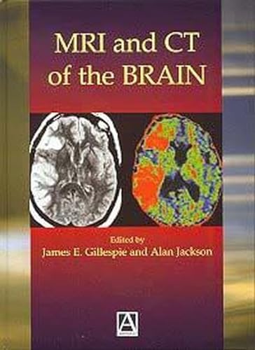 Stock image for MRI and CT of the Brain for sale by WorldofBooks