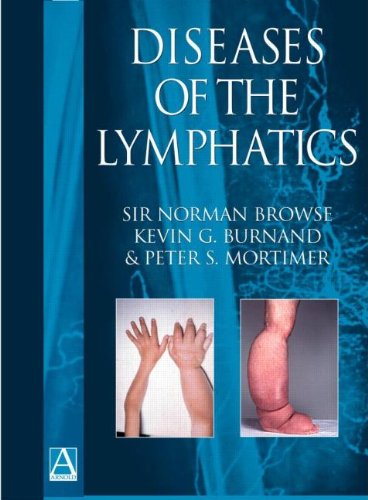 Beispielbild fr Diseases of the Lymphatics zum Verkauf von Anybook.com