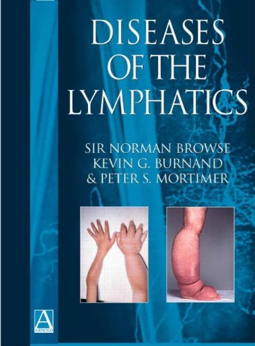 Stock image for Diseases of the Lymphatics for sale by Better World Books Ltd