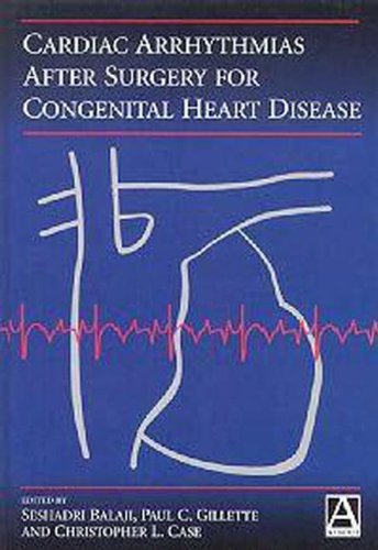 Stock image for Cardiac Arrythmias after Surgery for Congenital Heart Disease for sale by Irish Booksellers