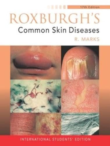 9780340762332: Roxburgh's Common Skin Diseases