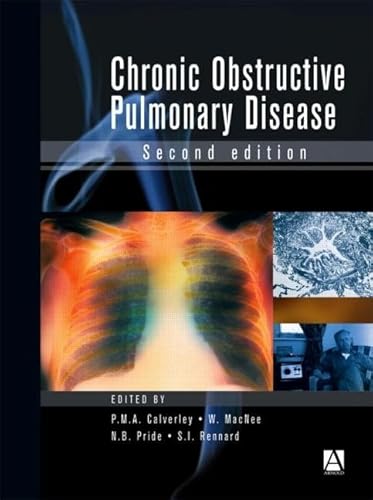 Imagen de archivo de Chronic Obstructive Pulmonary Disease a la venta por Better World Books: West