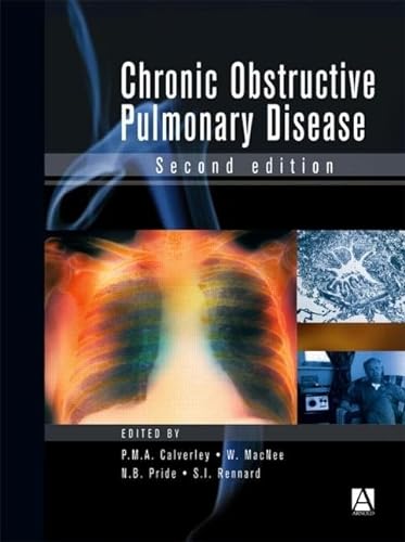 9780340807187: Chronic Obstructive Pulmonary Disease