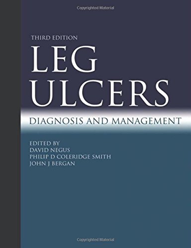 Leg Ulcers: Diagnosis and Management