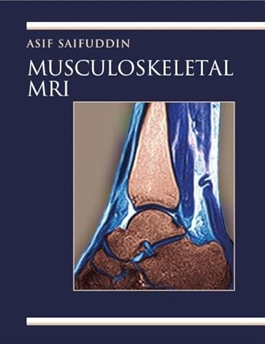 Stock image for Musculoskeletal MRI for sale by Anybook.com