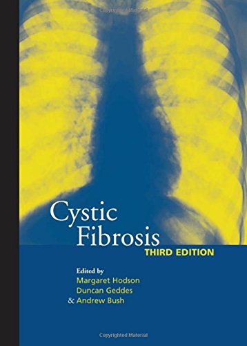 Imagen de archivo de Cystic Fibrosis a la venta por Better World Books