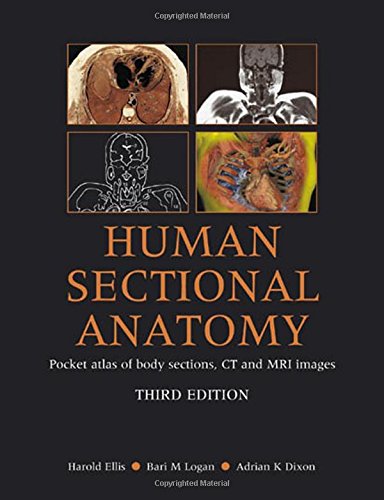 9780340912225: Human Sectional Anatomy: Atlas of Body Sections, CT and MRI Images, Third Edition
