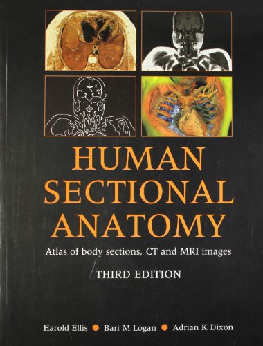 9780340967782: Human Sectional Anatomy Atlas of Body Sections, CT and MRI Images